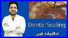 20-Years-Of-Dental-Calculus-Removed-With-Ultrasonic-Scaler-Tartar-And-Calculus-Removal-Part-1-01-ad
