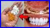 Teeth-Whitening-And-Scaling-At-Home-In-1-Minute-You-Will-Get-Pearl-White-Teeth-01-fv